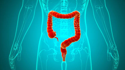 intestinos