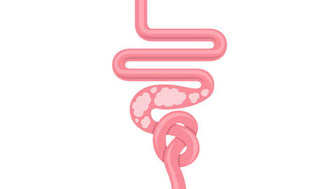 inflamación_abdominal